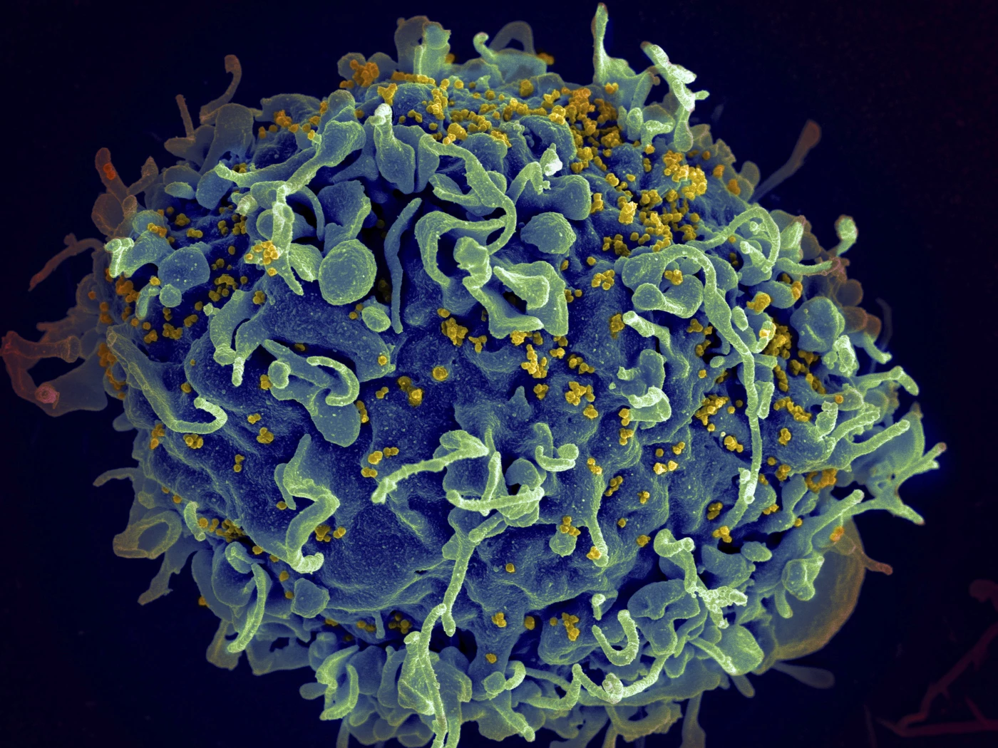 Image of Dhi Qar faces rising HIV cases amid stigma, calls for expanded testing